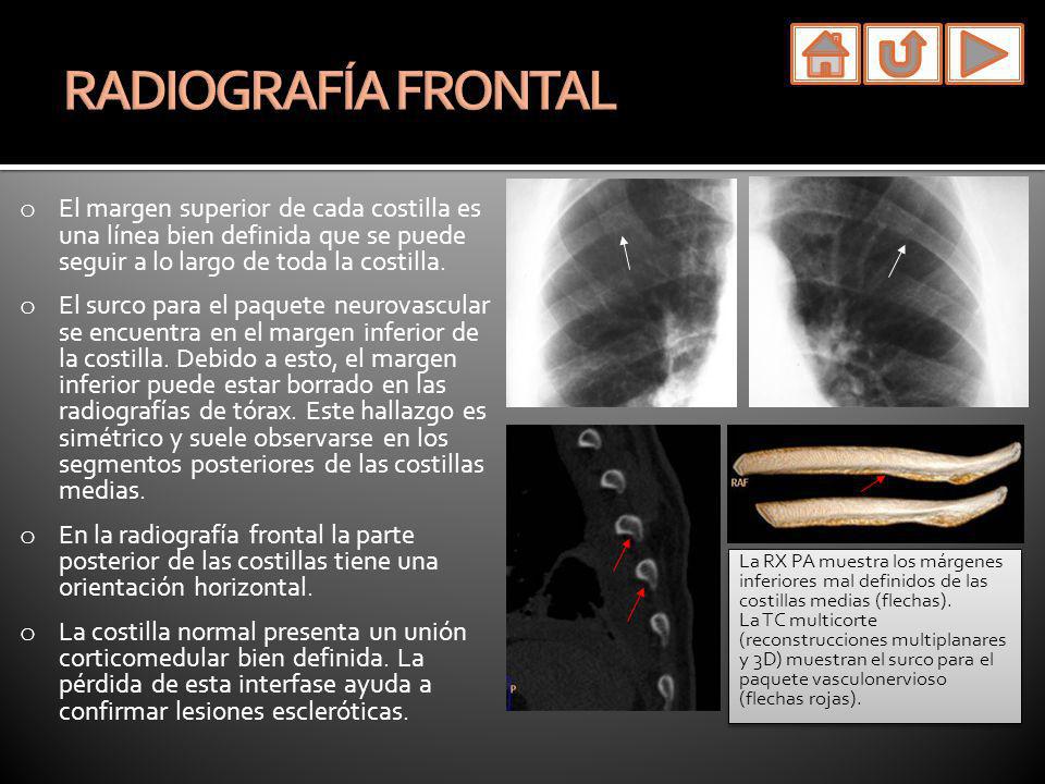 próstata y vaso nerviovascular tc 1 próstata y vaso nerviovascular tc 1